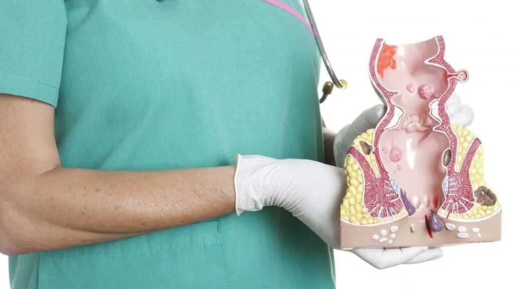 Bị Trĩ Khi Mang Thai: Nguyên Nhân, Dấu Hiệu Và Cách Xử Lý Hiệu Quả