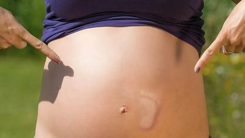 Bị Đầy Bụng Khi Mang Thai 3 Tháng Đầu: Nguyên Nhân và Cách Xử Lý Hiệu Quả
