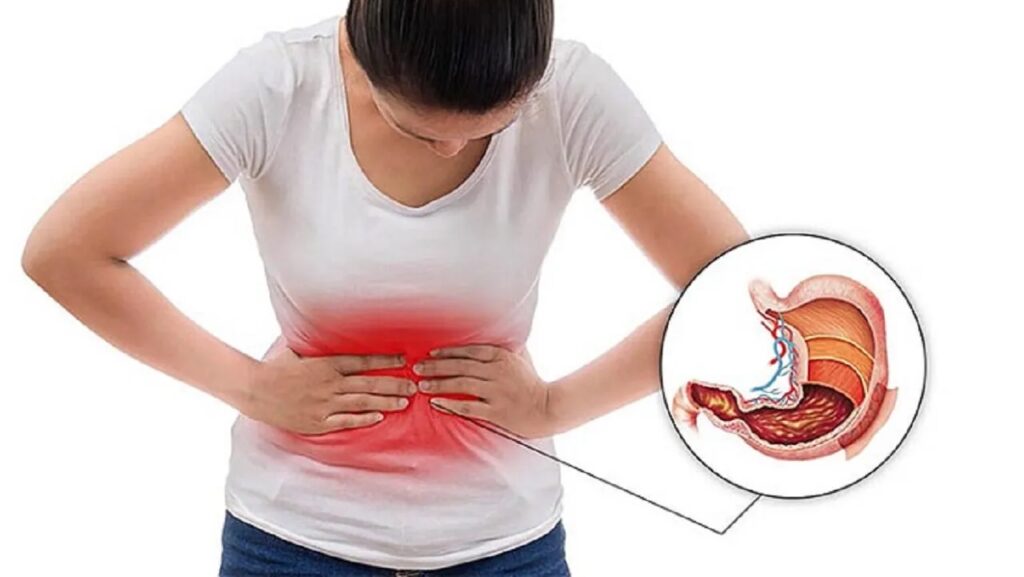 Đau Dạ Dày Khi Mang Thai: Nguyên Nhân, Cách Giảm Đau Hiệu Quả & Lời Khuyên Từ Chuyên Gia