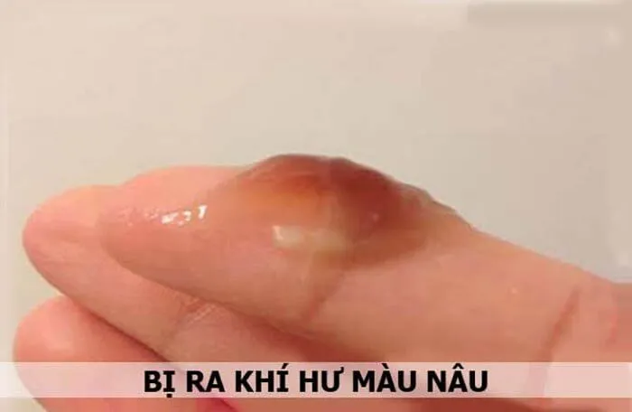 Mang Thai Ra Máu Màu Nâu Nhưng Không Đau Bụng: Điều Gì Mẹ Bầu Cần Biết?
