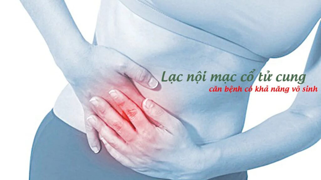 Lạc Nội Mạc Tử Cung Có Mang Thai Được Không: Giải Đáp Từ Chuyên Gia