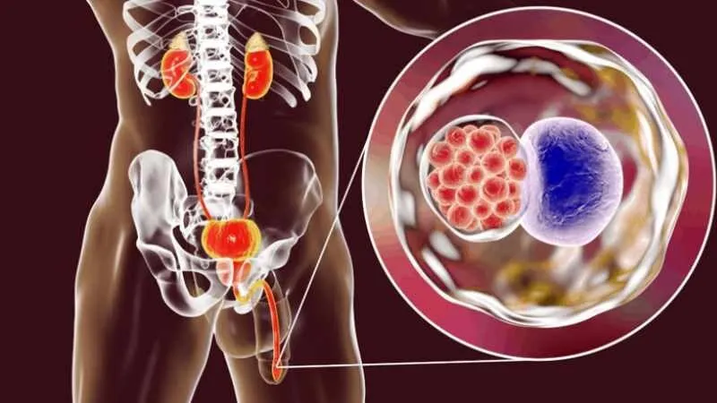 Viêm Đường Tiết Niệu Khi Mang Thai: Dấu Hiệu, Nguyên Nhân & Cách Điều Trị An Toàn