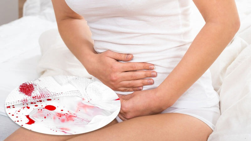 Ra Máu Như Hành Kinh Khi Mang Thai Tháng Đầu: Nguyên Nhân Và Cách Xử Lý