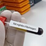 Chỉ Số Fibrinogen Cao Khi Mang Thai: Hiểu Rõ và Quản Lý Đúng Cách